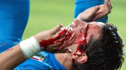 世界杯争议史最黑一幕：黑哨护送韩国金球绝杀意大利